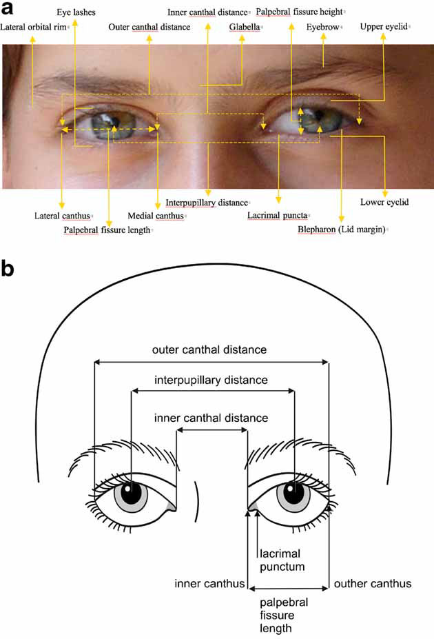 Elements Of Morphology Human Malformation Terminology Elements Of Morphology Human Malformation Terminology