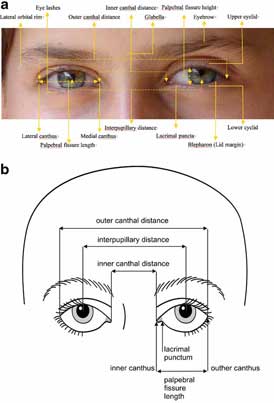 Elements of Morphology: Human Malformation Terminology