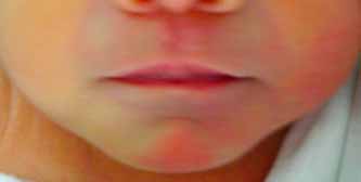 Less Than 5% of People Have These Rare Lips #anatomy Cupid's bow lips, cupid's  bow